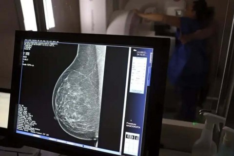 Nova lei reforça direito a três folgas por ano para exames preventivos